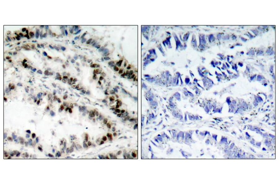 Immunohistochemistry - SMC1 (Phospho-Ser957) Antibody from Signalway Antibody (11198) - Antibodies.com