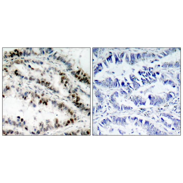 Immunohistochemistry - SMC1 (Phospho-Ser957) Antibody from Signalway Antibody (11198) - Antibodies.com