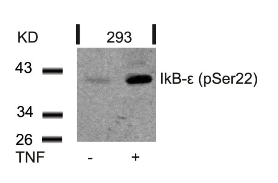 Western blot - IkB-e (Phospho-Ser22) Antibody from Signalway Antibody (11213) - Antibodies.com