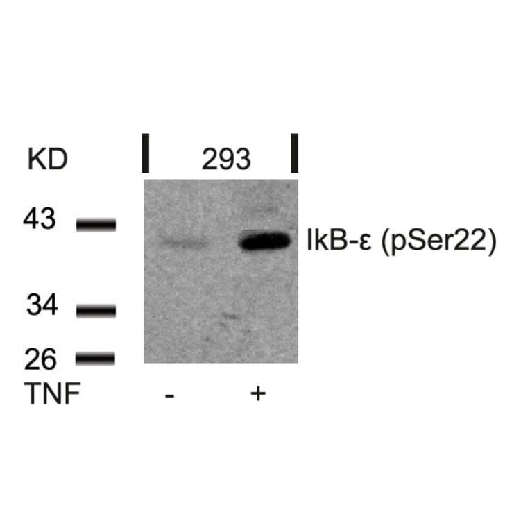 Western blot - IkB-e (Phospho-Ser22) Antibody from Signalway Antibody (11213) - Antibodies.com