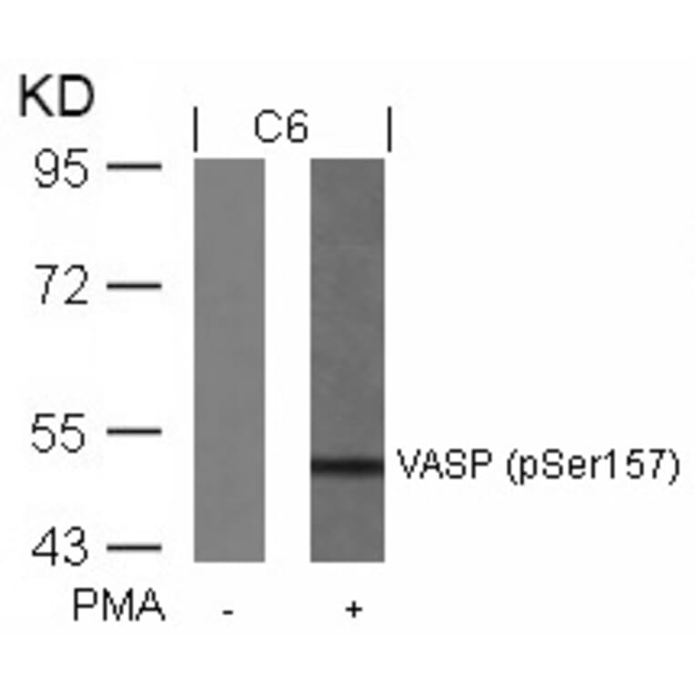 Western blot - VASP (Phospho-Ser157) Antibody from Signalway Antibody (11214) - Antibodies.com