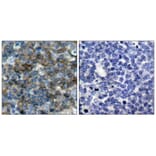 Immunohistochemistry - VASP (Phospho-Ser157) Antibody from Signalway Antibody (11214) - Antibodies.com