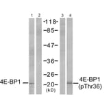 Western blot - 4E-BP1 (Phospho-Thr37) Antibody from Signalway Antibody (11222) - Antibodies.com