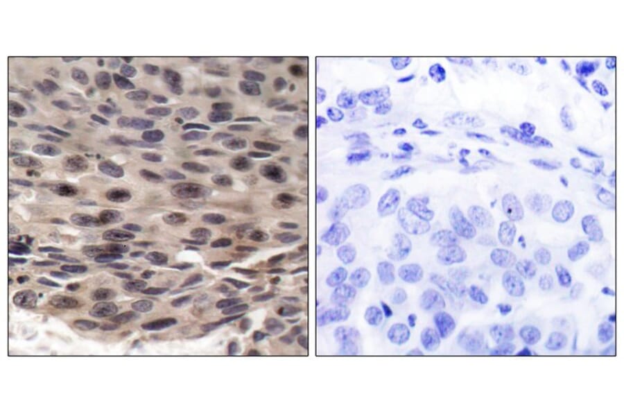 Immunohistochemistry - 4E-BP1 (Phospho-Thr37) Antibody from Signalway Antibody (11222) - Antibodies.com