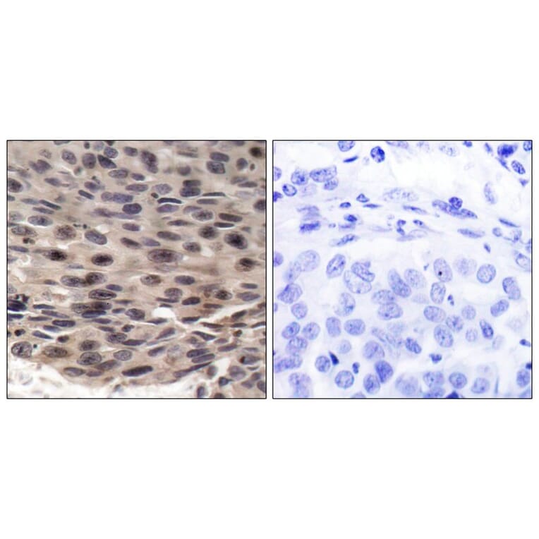 Immunohistochemistry - 4E-BP1 (Phospho-Thr37) Antibody from Signalway Antibody (11222) - Antibodies.com
