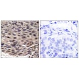 Immunohistochemistry - 4E-BP1 (Phospho-Thr37) Antibody from Signalway Antibody (11222) - Antibodies.com