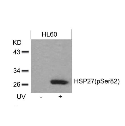 Western blot - HSP27 (Phospho-Ser82) Antibody from Signalway Antibody (11248) - Antibodies.com