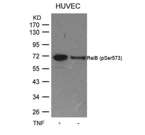 Western blot - RelB (Phospho-Ser573) Antibody from Signalway Antibody (11255) - Antibodies.com