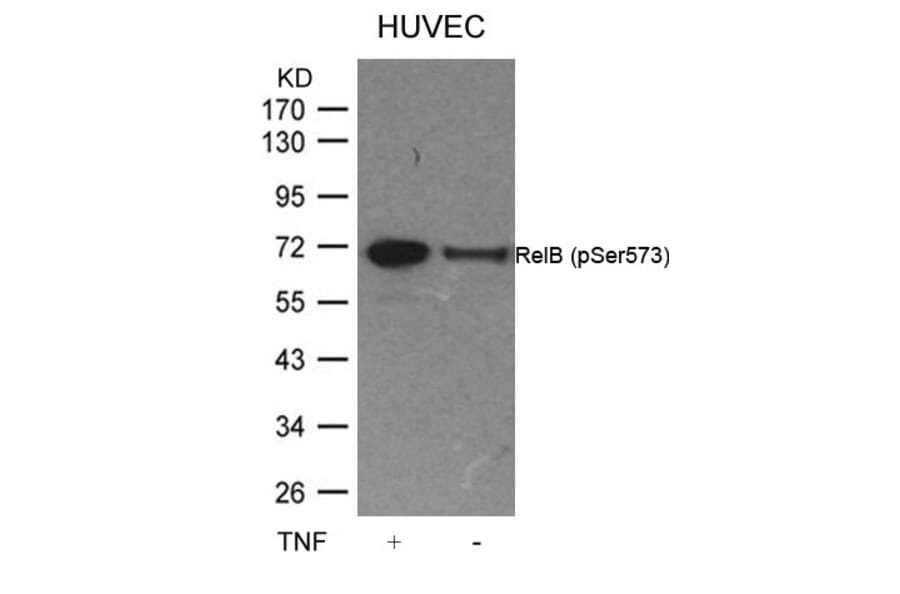 Western blot - RelB (Phospho-Ser573) Antibody from Signalway Antibody (11255) - Antibodies.com
