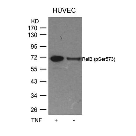 Western blot - RelB (Phospho-Ser573) Antibody from Signalway Antibody (11255) - Antibodies.com