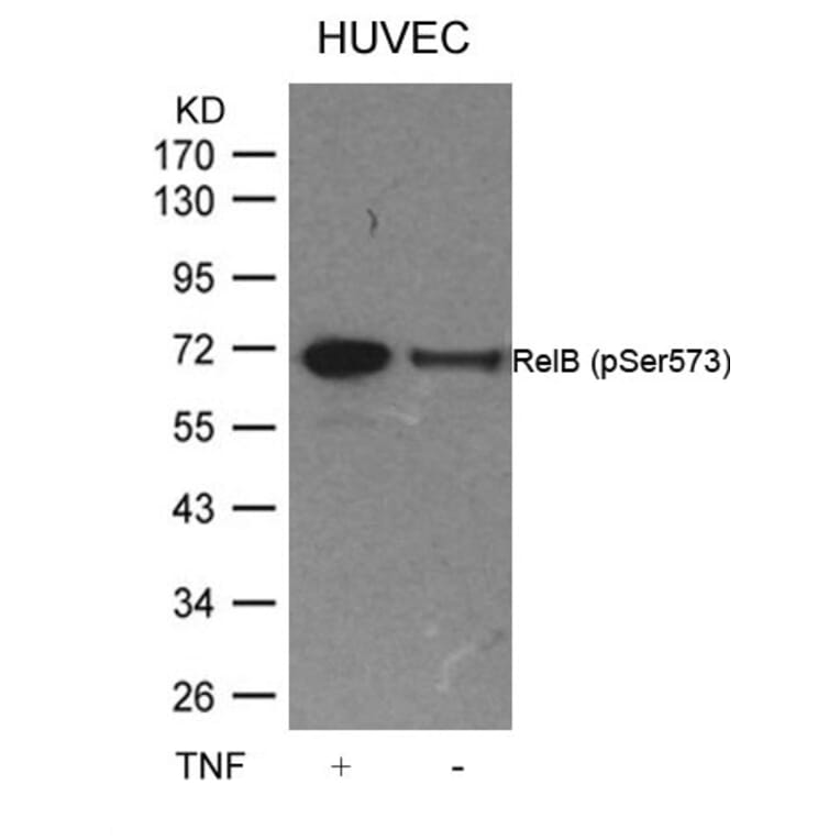 Western blot - RelB (Phospho-Ser573) Antibody from Signalway Antibody (11255) - Antibodies.com