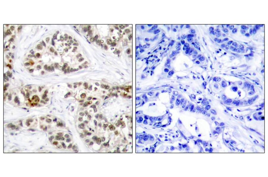 Immunohistochemistry - RelB (Phospho-Ser573) Antibody from Signalway Antibody (11255) - Antibodies.com