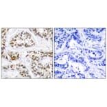 Immunohistochemistry - RelB (Phospho-Ser573) Antibody from Signalway Antibody (11255) - Antibodies.com