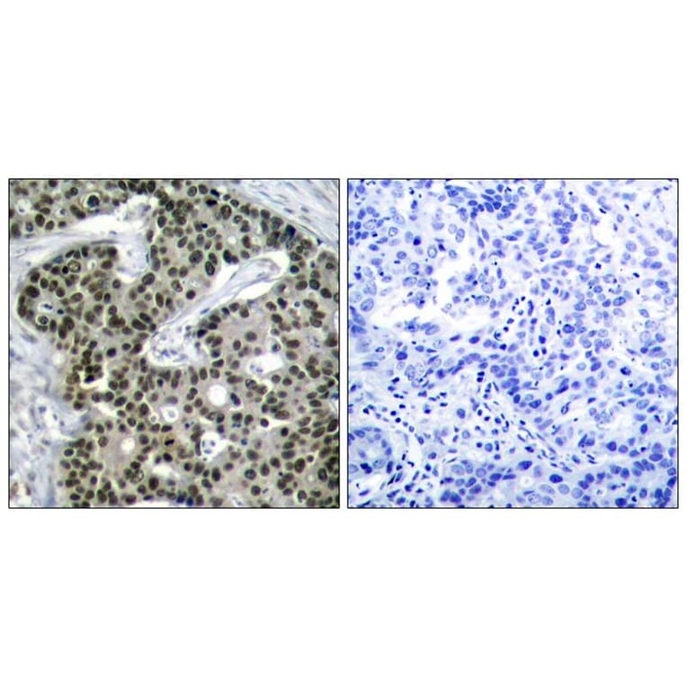 Immunohistochemistry - HSF1 (phospho-Ser303) Antibody from Signalway Antibody (11263) - Antibodies.com