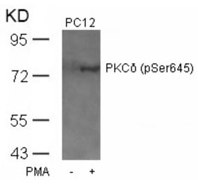 Western blot - PKCd (Phospho-Ser645) Antibody from Signalway Antibody (11296) - Antibodies.com