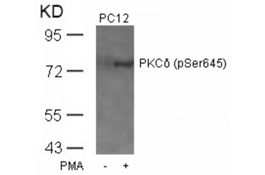 Western blot - PKCd (Phospho-Ser645) Antibody from Signalway Antibody (11296) - Antibodies.com