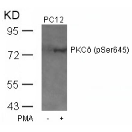 Western blot - PKCd (Phospho-Ser645) Antibody from Signalway Antibody (11296) - Antibodies.com