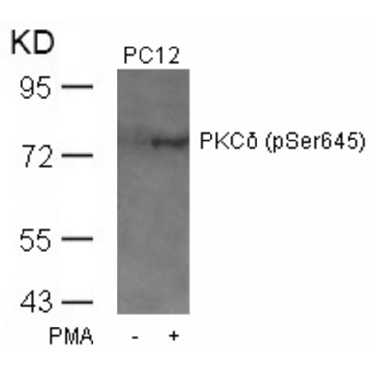 Western blot - PKCd (Phospho-Ser645) Antibody from Signalway Antibody (11296) - Antibodies.com