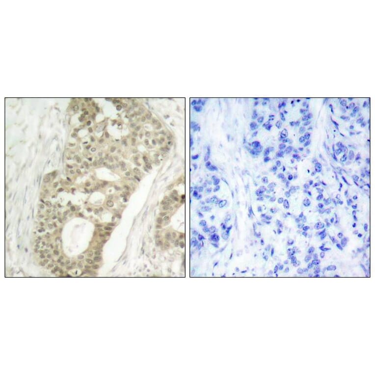 Immunohistochemistry - PKCd (Phospho-Ser645) Antibody from Signalway Antibody (11296) - Antibodies.com