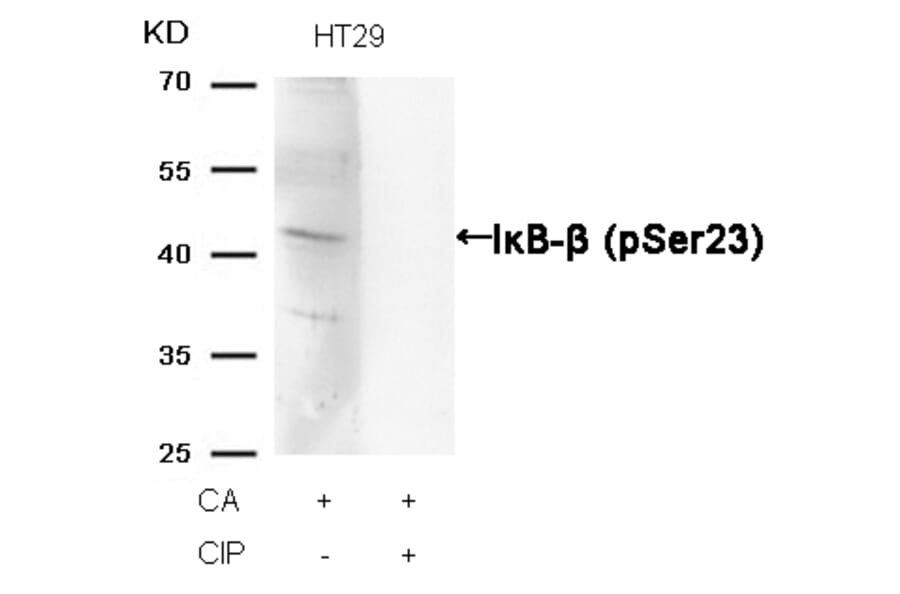 Western blot - IkB-b (Phospho-Ser23) Antibody from Signalway Antibody (11304) - Antibodies.com