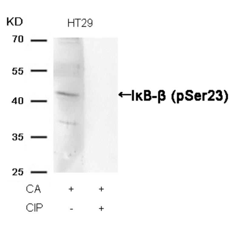 Western blot - IkB-b (Phospho-Ser23) Antibody from Signalway Antibody (11304) - Antibodies.com