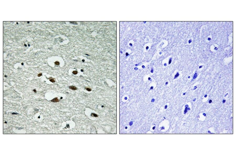 Immunohistochemistry - Chk1 (Phospho-Ser296) Antibody from Signalway Antibody (11673) - Antibodies.com