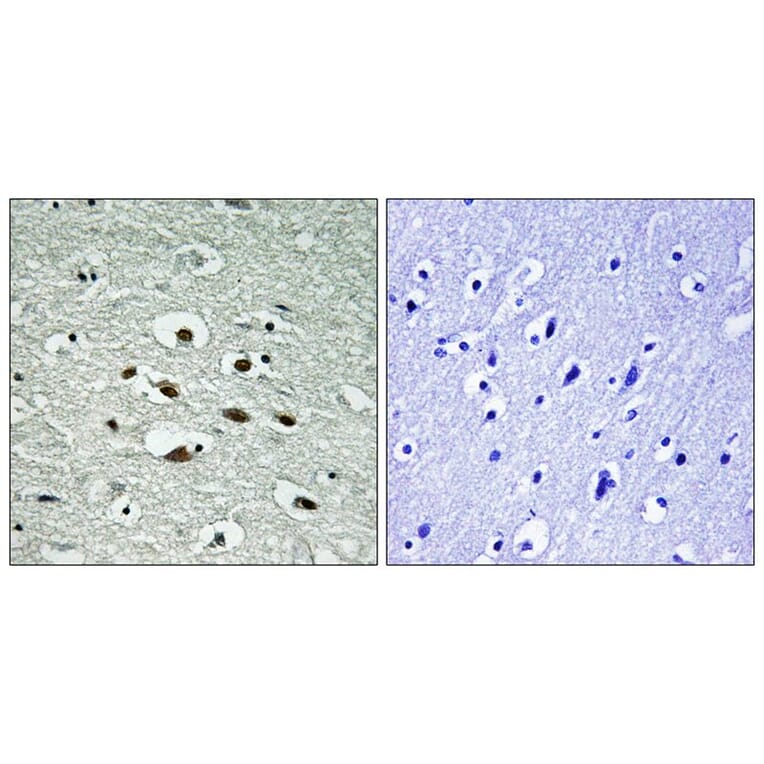 Immunohistochemistry - Chk1 (Phospho-Ser296) Antibody from Signalway Antibody (11673) - Antibodies.com