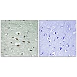 Immunohistochemistry - Chk1 (Phospho-Ser296) Antibody from Signalway Antibody (11673) - Antibodies.com