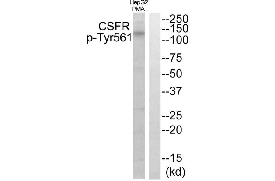 Western blot - CSFR (Phospho-Tyr561) Antibody from Signalway Antibody (11688) - Antibodies.com
