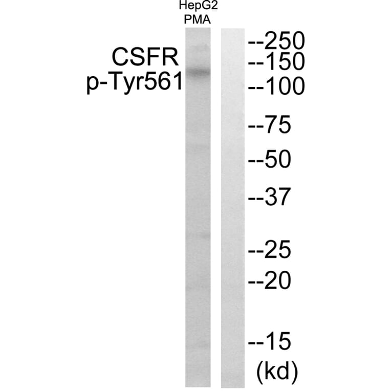 Western blot - CSFR (Phospho-Tyr561) Antibody from Signalway Antibody (11688) - Antibodies.com