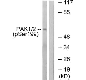 Western blot - PAK1 (Phospho-Ser199) Antibody from Signalway Antibody (11699) - Antibodies.com