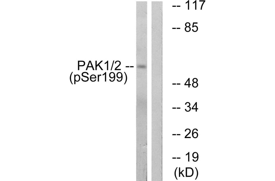 Western blot - PAK1 (Phospho-Ser199) Antibody from Signalway Antibody (11699) - Antibodies.com