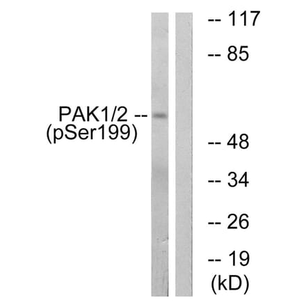 Western blot - PAK1 (Phospho-Ser199) Antibody from Signalway Antibody (11699) - Antibodies.com