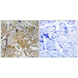 Immunohistochemistry - PAK1 (Phospho-Ser199) Antibody from Signalway Antibody (11699) - Antibodies.com