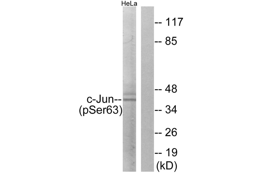 Western blot - c-Jun (Phospho-Ser63) Antibody from Signalway Antibody (11710) - Antibodies.com