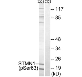 Western blot - STMN1 (Phospho-Ser63) Antibody from Signalway Antibody (11722) - Antibodies.com
