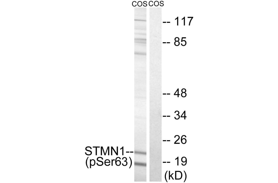 Western blot - STMN1 (Phospho-Ser63) Antibody from Signalway Antibody (11722) - Antibodies.com