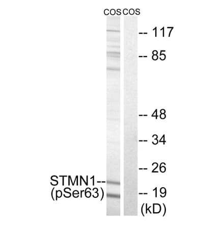 Western blot - STMN1 (Phospho-Ser63) Antibody from Signalway Antibody (11722) - Antibodies.com