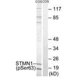 Western blot - STMN1 (Phospho-Ser63) Antibody from Signalway Antibody (11722) - Antibodies.com