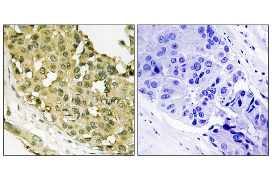 Immunohistochemistry - STMN1 (Phospho-Ser63) Antibody from Signalway Antibody (11722) - Antibodies.com