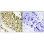 Immunohistochemistry - STMN1 (Phospho-Ser63) Antibody from Signalway Antibody (11722) - Antibodies.com