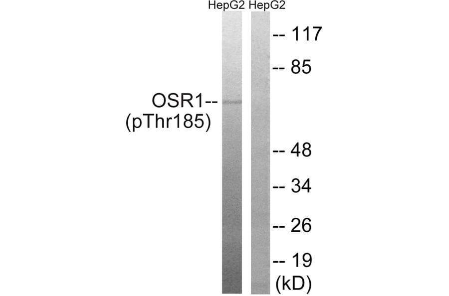 Western blot - OSR1 (Phospho-Thr185) Antibody from Signalway Antibody (11746) - Antibodies.com