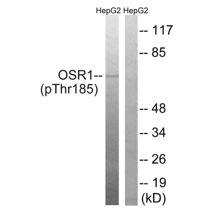 Western blot - OSR1 (Phospho-Thr185) Antibody from Signalway Antibody (11746) - Antibodies.com