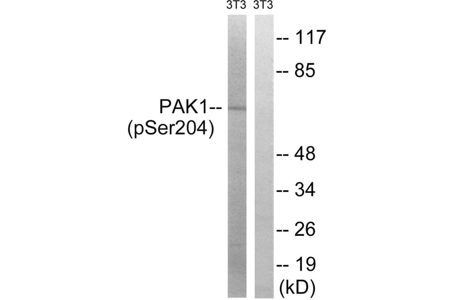 Western blot - PAK1 (Phospho-Ser204) Antibody from Signalway Antibody (11748) - Antibodies.com
