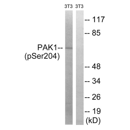 Western blot - PAK1 (Phospho-Ser204) Antibody from Signalway Antibody (11748) - Antibodies.com