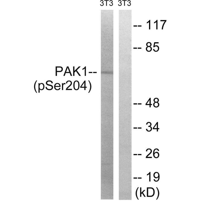 Western blot - PAK1 (Phospho-Ser204) Antibody from Signalway Antibody (11748) - Antibodies.com