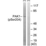 Western blot - PAK1 (Phospho-Ser204) Antibody from Signalway Antibody (11748) - Antibodies.com