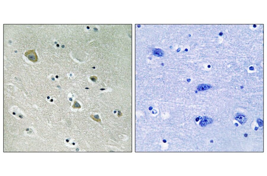 Immunohistochemistry - PAK1 (Phospho-Ser204) Antibody from Signalway Antibody (11748) - Antibodies.com