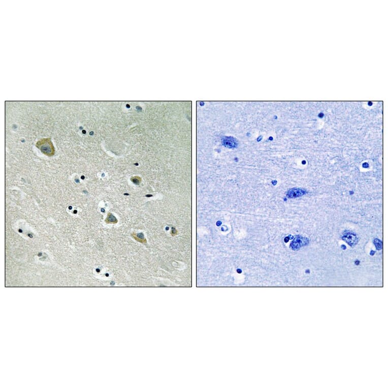 Immunohistochemistry - PAK1 (Phospho-Ser204) Antibody from Signalway Antibody (11748) - Antibodies.com