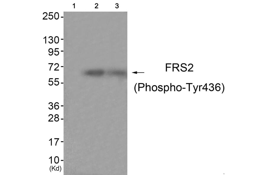 Western blot - FRS2 (Phospho-Tyr436) Antibody from Signalway Antibody (11769) - Antibodies.com